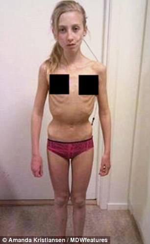 Super skinny blonde shows off her extreme anorexic body
